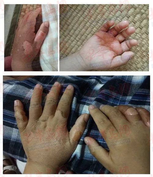 ���ۣ����uһ�׃���@�H�������p�և�(y��n)����͑Ƥ���׃��@����������wԭ��